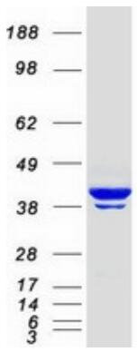 Coomassie blue staining of purified ACTB protein.
